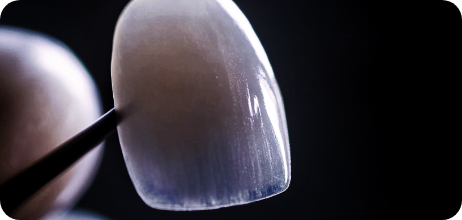 강도와 뷰티를 잡은 리튬 다이 실리케이트 블럭