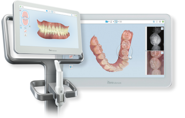 iTero 최신형 3D 스캔 / 성장 진단 장비