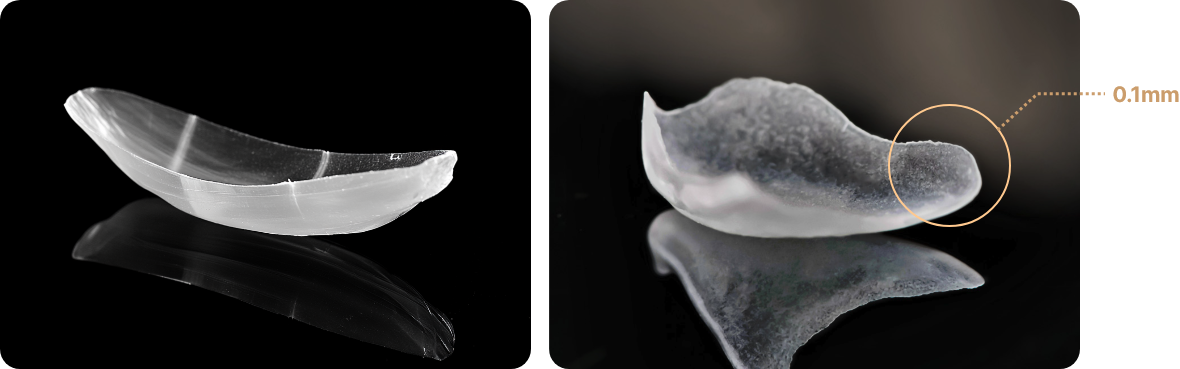 숨을 쉬듯 자연스러운 라미네이트