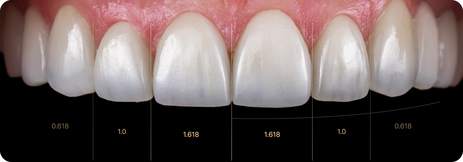 우리 얼굴에서 미소는 첫인상을 좌우합니다.