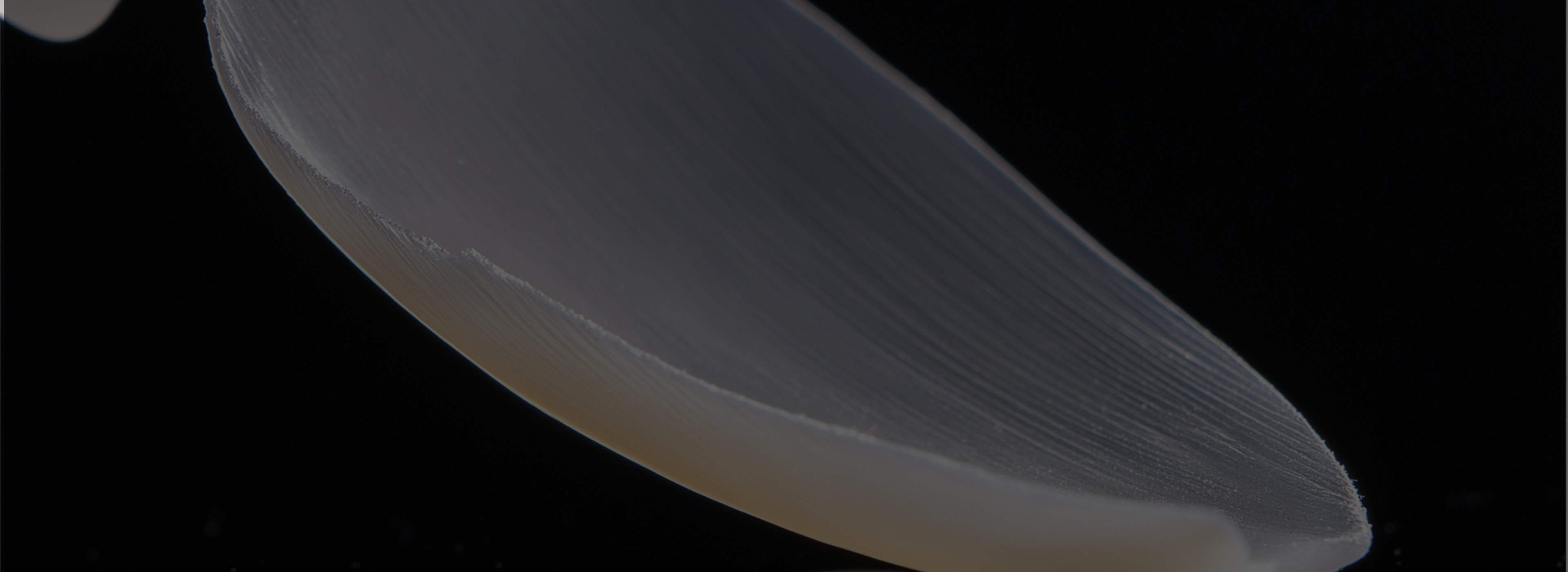 더서울치과 라미네이트