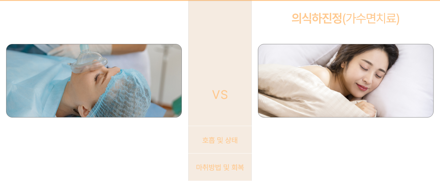 수면마취 (의식하진정)