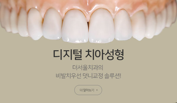 치아성형